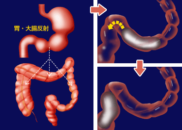 便意のメカニズム